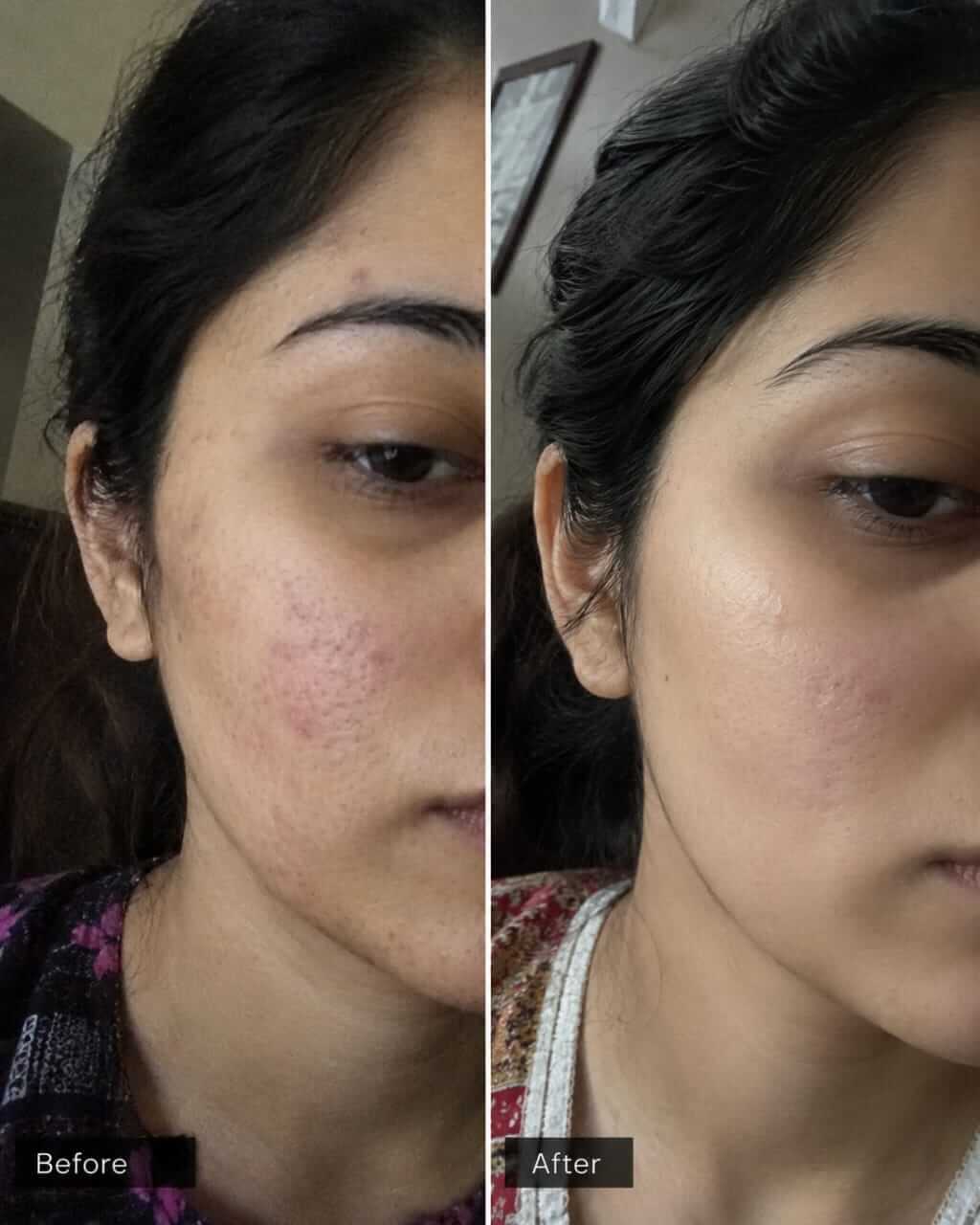 Skin Repair before after result