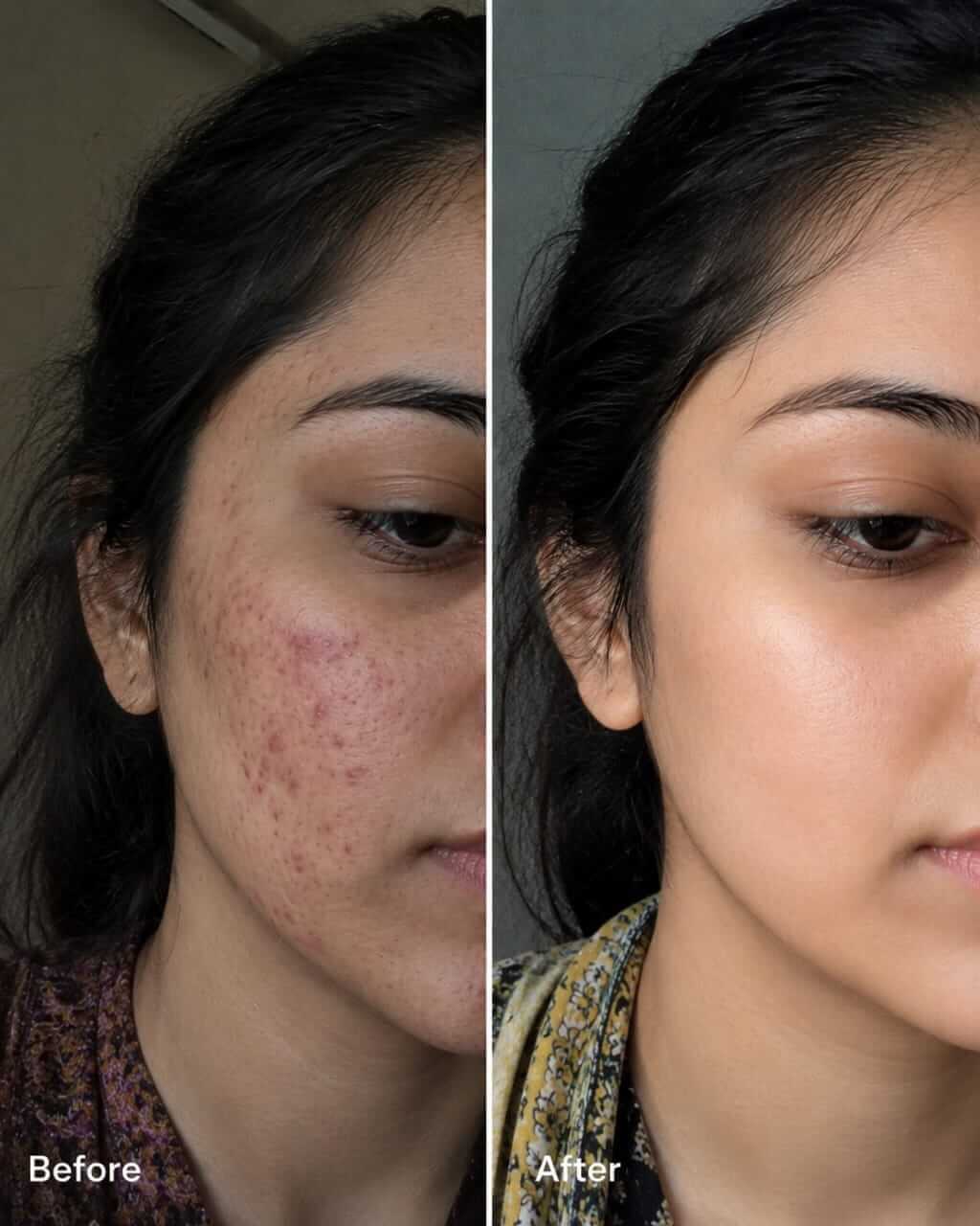Skin Repair before after result