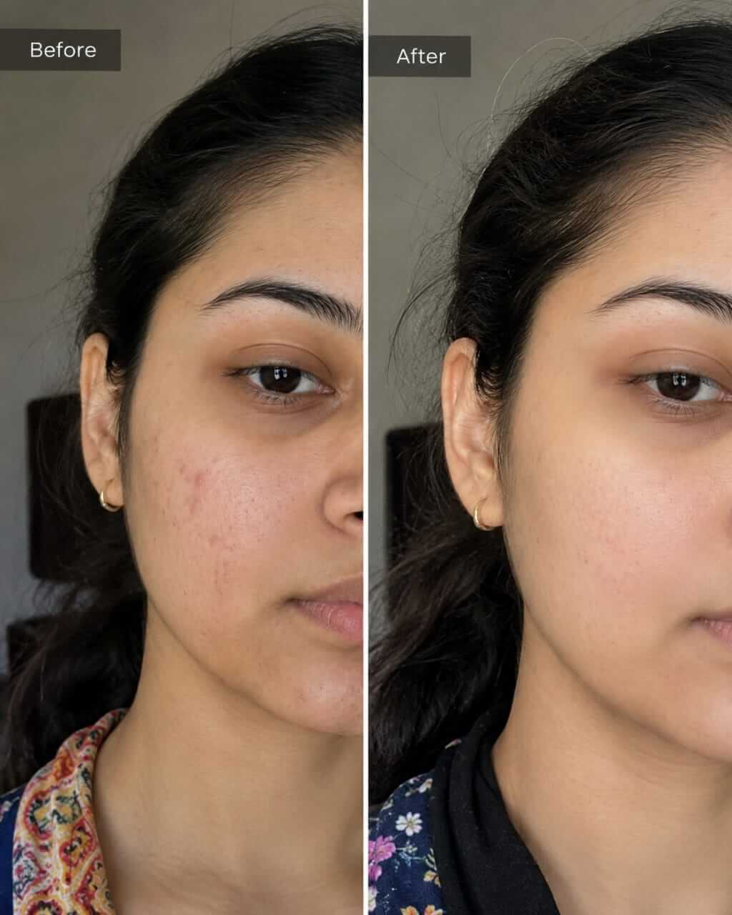 Hydra Boost Gel before after result